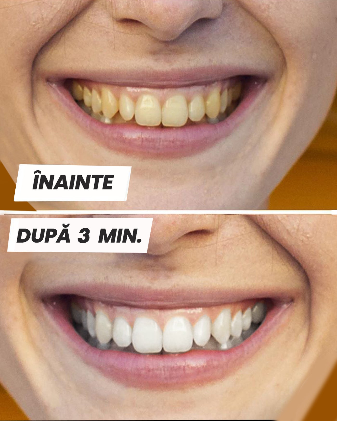 Pastă de albire a dinților™