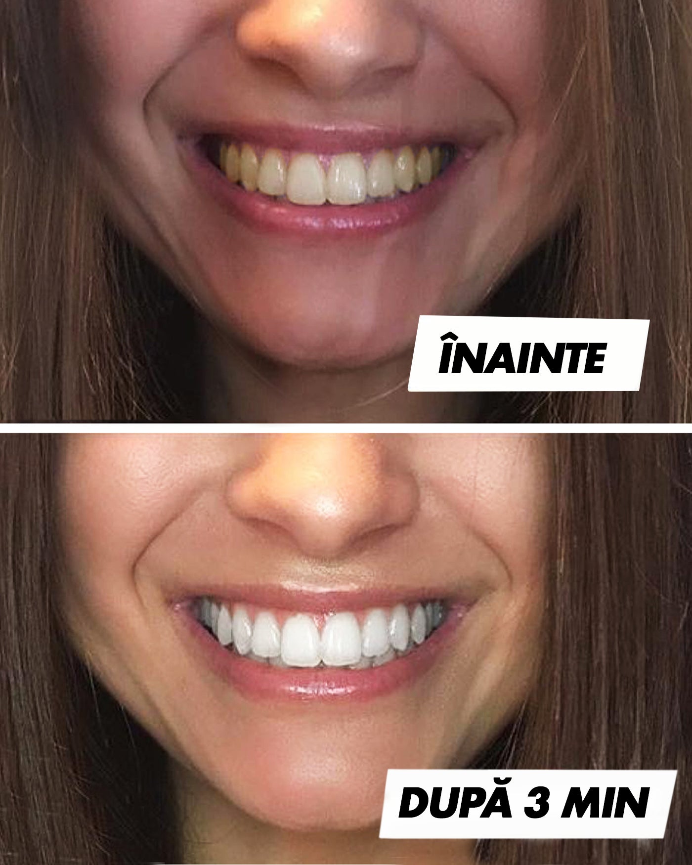 Pastă de albire a dinților™