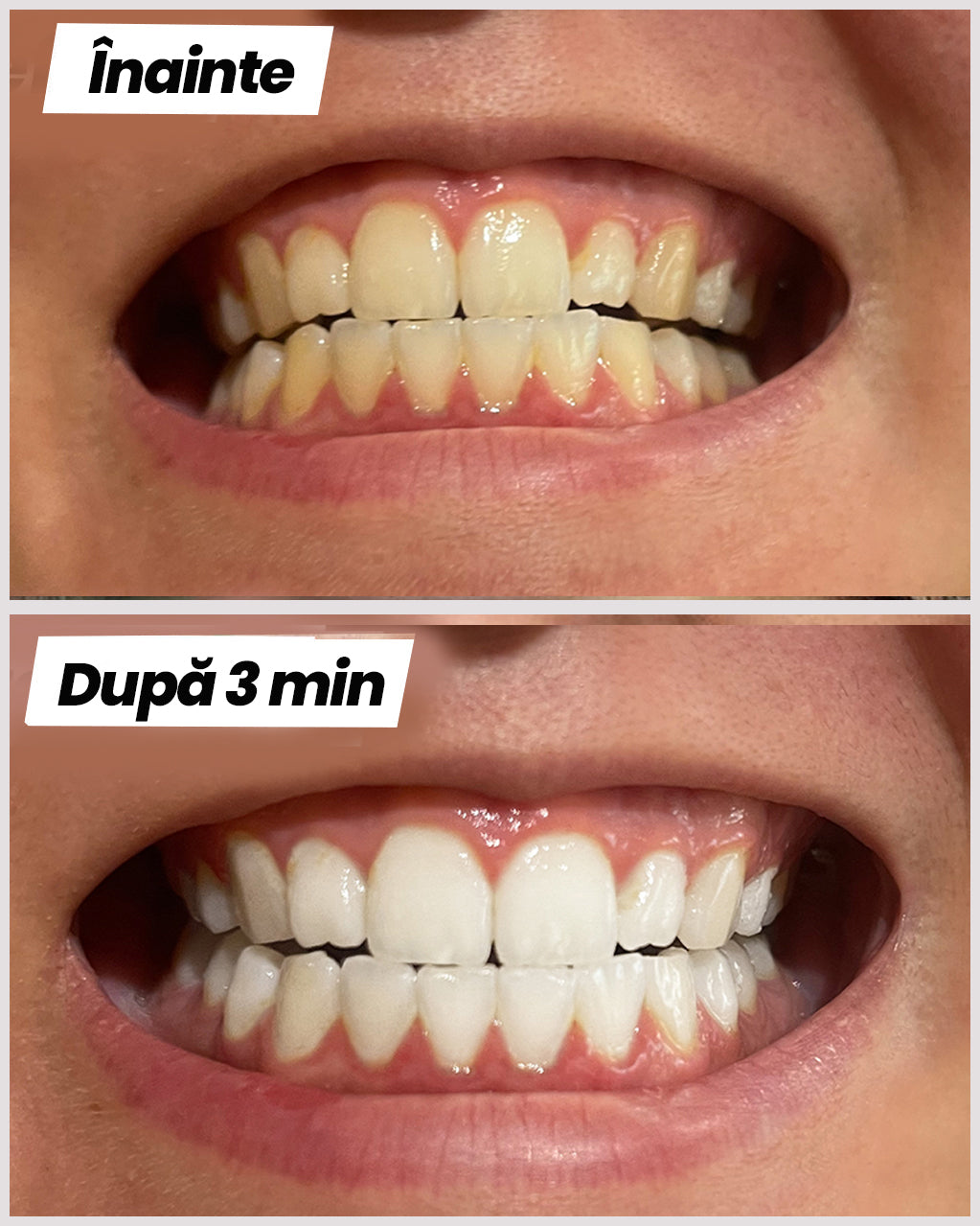 Pastă de albire a dinților™